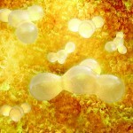 Guidelines for autologous fat grafting and PRP
