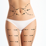 Cosmetic surgery stats: number of surgeries remains stable amid calls for greater regulation of quick fix solutions