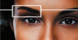 Upper eyelid blepharoplasty