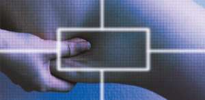 Skin Laxity: A New Intradermal Injective Treatment