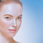 What’s new in the management of acne and acne scarring