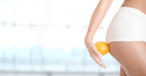 Endo Announces Submission of Biologics License Application to FDA for Collagenase Clostridium Histolyticum (CCH) in Patients with Cellulite