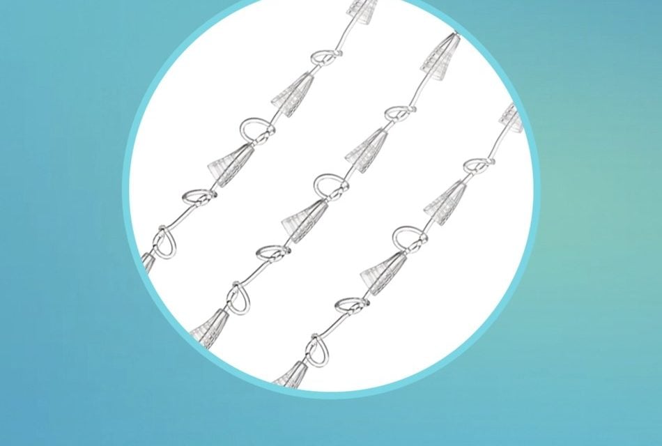 Suneva Medical to distribute Silhouette Instalift® sutures in North America
